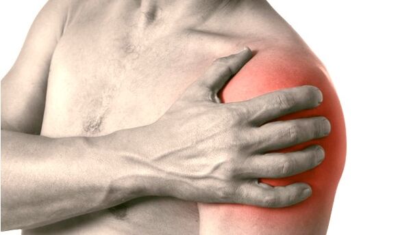 Una spalla gonfia, rossa e ingrossata - sintomi di osteoartrosi di grado 2-3 dell'articolazione della spalla