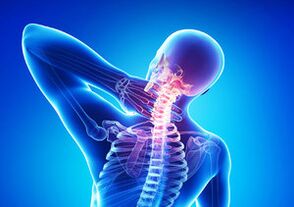 Segni di osteocondosi cervicale
