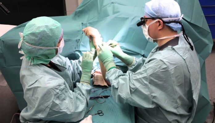 trattamento chirurgico del dolore alle articolazioni delle dita