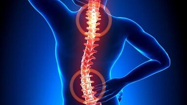 Meccanismo di sviluppo dell'osteocondrosi