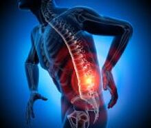 diverse cause di mal di schiena