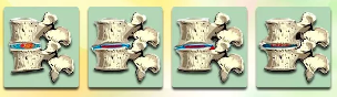 Le fasi di sviluppo di osteocondrosi